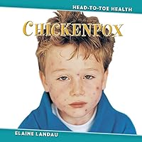 Chickenpox (Head-to-Toe Health) Chickenpox (Head-to-Toe Health) Library Binding