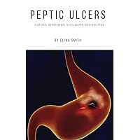 PEPTIC ULCERS: CAUSES, SYMPTOMS, SOLUTIONS AND RECIPES PEPTIC ULCERS: CAUSES, SYMPTOMS, SOLUTIONS AND RECIPES Kindle Paperback