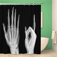 Bathroom Shower Curtain Finger X Ray Hand Bone Index Accident Body Broken Condition Polyester Fabric 72x78 inches Waterproof Bath Curtain Set with Hooks
