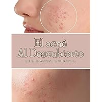 El acné al descubierto: De los mitos al control (Spanish Edition) El acné al descubierto: De los mitos al control (Spanish Edition) Paperback Kindle
