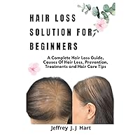 HAIR LOSS SOLUTION FOR BEGINNERS: A Complete Hair loss guide, Causes of hair loss, Prevention, Treatments and Hair care tips HAIR LOSS SOLUTION FOR BEGINNERS: A Complete Hair loss guide, Causes of hair loss, Prevention, Treatments and Hair care tips Paperback Kindle