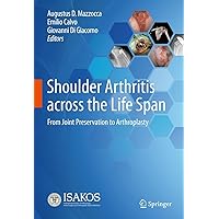 Shoulder Arthritis across the Life Span: From Joint Preservation to Arthroplasty Shoulder Arthritis across the Life Span: From Joint Preservation to Arthroplasty Kindle Hardcover