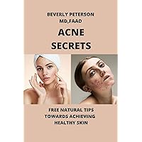 ACNE SECRETS: Free tips towards achieving healthy skin ACNE SECRETS: Free tips towards achieving healthy skin Kindle Paperback