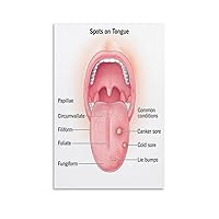 Different Tongue Symptoms Posters Tongue Diagnosis Disease Posters (6) Canvas Painting Posters And Prints Wall Art Pictures for Living Room Bedroom Decor 08x12inch(20x30cm) Unframe-style