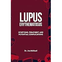 systemic lupus erythematosus: Symptoms, Treatment and Potential Complications