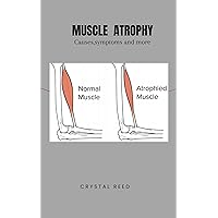 MUSCLE ATROPHY: Causes,symptoms and more MUSCLE ATROPHY: Causes,symptoms and more Kindle Paperback