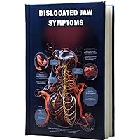 Dislocated Jaw Symptoms: Understand the symptoms of a dislocated jaw, a condition that can cause pain and difficulty in speaking or eating. Dislocated Jaw Symptoms: Understand the symptoms of a dislocated jaw, a condition that can cause pain and difficulty in speaking or eating. Paperback