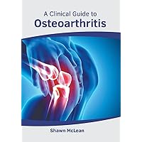 A Clinical Guide to Osteoarthritis A Clinical Guide to Osteoarthritis Hardcover