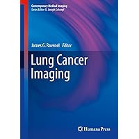Lung Cancer Imaging (Contemporary Medical Imaging) Lung Cancer Imaging (Contemporary Medical Imaging) Kindle Hardcover Paperback