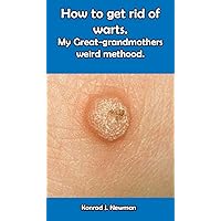 How to get rid of warts. My Great-grandmothers weird method.
