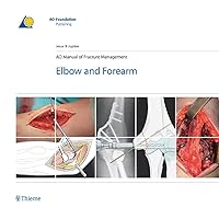 AO Manual of Fracture Management - Elbow & Forearm (AO-Publishing) AO Manual of Fracture Management - Elbow & Forearm (AO-Publishing) Hardcover Kindle