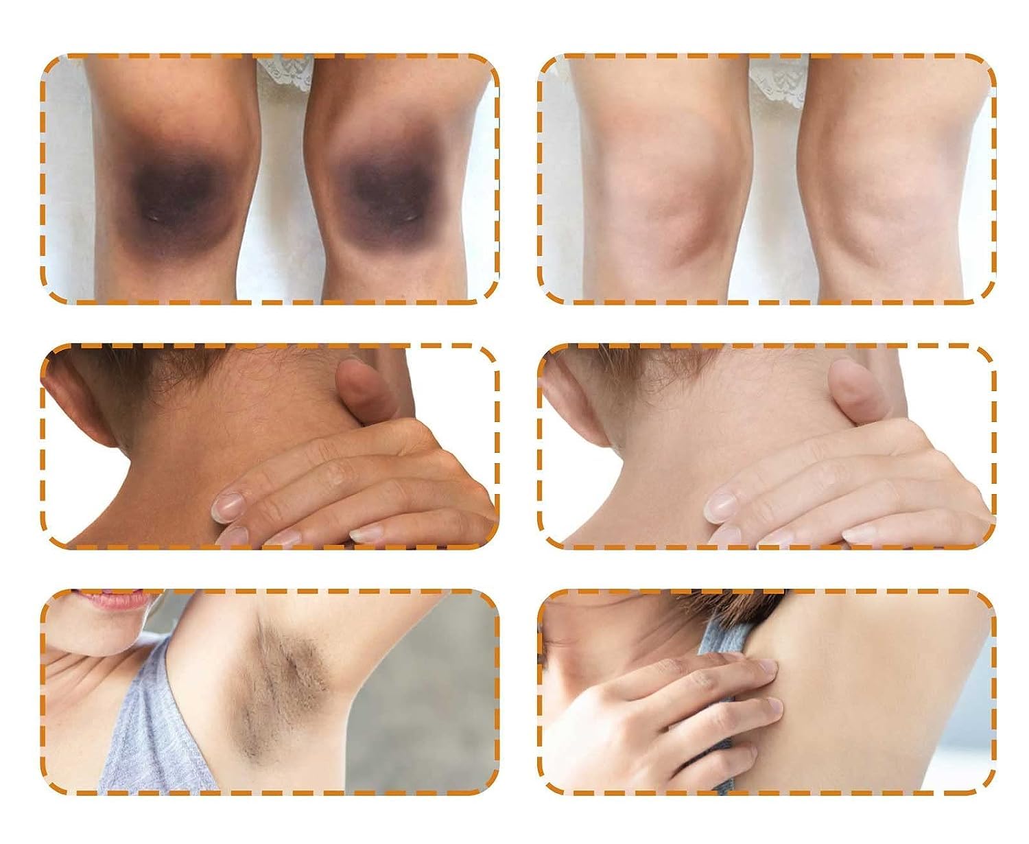 Dark Spot Corrector Skin Lightening Cream for Body, Intimate Areas, Underarms, Armpit, Knees, Legs, Elbows and Inner Thigh, Whitening Cream Dark Spot Remover for Sensitive Areas (1.76 Fl Oz)