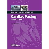 The Nuts and Bolts of Cardiac Pacing 2nd Edition by Kenny, Tom (2008) Paperback The Nuts and Bolts of Cardiac Pacing 2nd Edition by Kenny, Tom (2008) Paperback Paperback Kindle