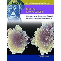 Skin Cancer: Current And Emerging Trends in Detection And Treatment (Cancer & Modern Science) Skin Cancer: Current And Emerging Trends in Detection And Treatment (Cancer & Modern Science) Library Binding Paperback