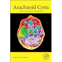 Arachnoid Cysts: Clinical and Surgical Management Arachnoid Cysts: Clinical and Surgical Management Paperback Kindle