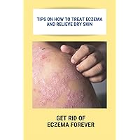 Tips On How To Treat Eczema And Relieve Dry Skin: Get Rid Of Eczema Forever: Overcome Eczema