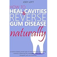 How to Heal Cavities and Reverse Gum Disease Naturally: a science-based, proven plan to heal teeth and gums using nutrition, balancing the metabolism, and natural therapies such as oil pulling How to Heal Cavities and Reverse Gum Disease Naturally: a science-based, proven plan to heal teeth and gums using nutrition, balancing the metabolism, and natural therapies such as oil pulling Paperback Kindle Audible Audiobook