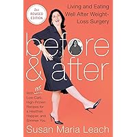 Before & After, Second Revised Edition: Living and Eating Well After Weight-Loss Surgery Before & After, Second Revised Edition: Living and Eating Well After Weight-Loss Surgery Paperback Kindle
