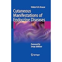 Cutaneous Manifestations of Endocrine Diseases Cutaneous Manifestations of Endocrine Diseases Kindle Hardcover Paperback