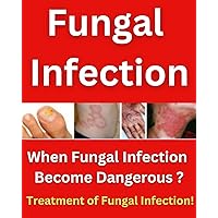 What is Fungal Infection? When Fungal Infection Become Dangerous ? Treatment of Fungal Infection ! What is Fungal Infection? When Fungal Infection Become Dangerous ? Treatment of Fungal Infection ! Kindle