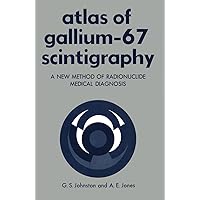 Atlas of Gallium-67 Scintigraphy: A New Method of Radionuclide Medical Diagnosis Atlas of Gallium-67 Scintigraphy: A New Method of Radionuclide Medical Diagnosis Kindle Paperback Hardcover