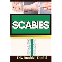 SCABIES : Expert Guide To Understanding Scabies Causes, Symptoms, Preventing, Treatment for optimal wellness SCABIES : Expert Guide To Understanding Scabies Causes, Symptoms, Preventing, Treatment for optimal wellness Kindle Paperback