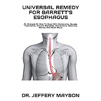 UNIVERSAL REMEDY FOR BARRETT'S ESOPHAGUS: An Analysis On How To Cope With Symptoms, Causes, Treatments, Natural Remedies, Preventions, Recovery Advice, And Much More.