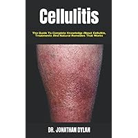 Cellulitis: The Guide To Complete Knowledge About Cellulitis, Treatments And Natural Remedies That Works Cellulitis: The Guide To Complete Knowledge About Cellulitis, Treatments And Natural Remedies That Works Paperback Kindle