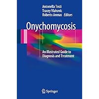 Onychomycosis: An Illustrated Guide to Diagnosis and Treatment Onychomycosis: An Illustrated Guide to Diagnosis and Treatment Paperback Kindle