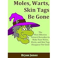 Moles, Warts, Skin Tags Be Gone: The Most Effective Natural Remedies to Make Your Moles, Warts, and Skin Tags Disappear For Good [Mole Removal, Wart Removal, Skin Tag Removal] Moles, Warts, Skin Tags Be Gone: The Most Effective Natural Remedies to Make Your Moles, Warts, and Skin Tags Disappear For Good [Mole Removal, Wart Removal, Skin Tag Removal] Kindle