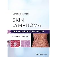Skin Lymphoma: The Illustrated Guide Skin Lymphoma: The Illustrated Guide Hardcover