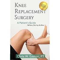 Knee Replacement Surgery, A Patient's Guide: Before, During & After Knee Replacement Surgery, A Patient's Guide: Before, During & After Paperback Kindle Hardcover