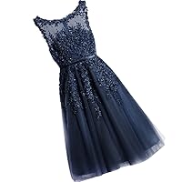 Women Short Evening Dress Prom Dress Lace With Pearls Cocktail Party Gowns