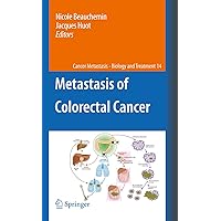 Metastasis of Colorectal Cancer (Cancer Metastasis - Biology and Treatment Book 14) Metastasis of Colorectal Cancer (Cancer Metastasis - Biology and Treatment Book 14) Kindle Hardcover Paperback