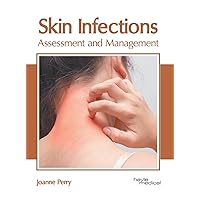 Skin Infections: Assessment and Management