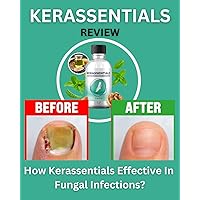 Kerassentials Review – How Kerassentials Effective In Fungal Infections? Save Your Money ! Kerassentials Review – How Kerassentials Effective In Fungal Infections? Save Your Money ! Kindle