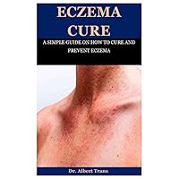 Eczema Cure: A SIMPLE GUIDE ON HOW TO CURE AND PREVENT ECZEMA Eczema Cure: A SIMPLE GUIDE ON HOW TO CURE AND PREVENT ECZEMA Paperback
