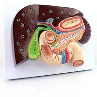 Teaching Model,Pathological Model of Pancreas, Medical Pathological Model of Pancreas, Medical Human Gastrointestinal Structure Model