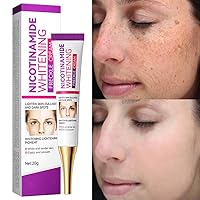 Dark Spot Remover for Face Skin Lightening Cream Hyperpigmentation Treatment Quick Effect Freckles Melasma Brown Spot Corrector Suitable for Men Women - 0.8 OZ