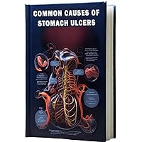 Common Causes of Stomach Ulcers: Discover the common triggers of stomach ulcers and learn about preventive measures and treatments for this digestive condition. Common Causes of Stomach Ulcers: Discover the common triggers of stomach ulcers and learn about preventive measures and treatments for this digestive condition. Paperback