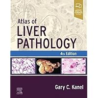 Atlas of Liver Pathology (Atlas of Surgical Pathology) Atlas of Liver Pathology (Atlas of Surgical Pathology) Hardcover Kindle