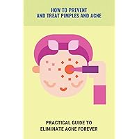 How To Prevent And Treat Pimples And Acne: Practical Guide To Eliminate Acne Forever: Pimples Cure Tips