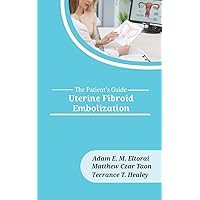 Uterine Fibroid Embolization (The Patient's Guide)