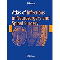 Atlas of Infections in Neurosurgery and Spinal Surgery Atlas of Infections in Neurosurgery and Spinal Surgery Kindle Hardcover Paperback