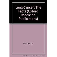 Lung Cancer: The Facts (The ^AFacts Series) Lung Cancer: The Facts (The ^AFacts Series) Hardcover Paperback