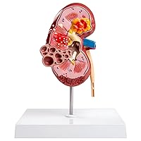 Kidney Model for Teaching with 2 Detachable Parts,24 Digital Labeled Kidney Model Anatomical Position Instructions for Understanding The Structure of The Human Kidney
