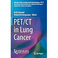 PET/CT in Lung Cancer (Clinicians’ Guides to Radionuclide Hybrid Imaging) PET/CT in Lung Cancer (Clinicians’ Guides to Radionuclide Hybrid Imaging) Kindle Paperback