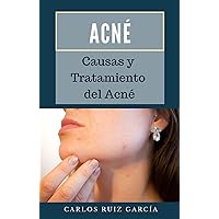 Acné: Causas y Tratamiento del Acné (Spanish Edition)
