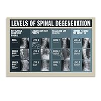 WENHUIMM Levels of Spinal Degeneration Chiropractors Spine Knowledge Guide Poster (11) Home Living Room Bedroom Decoration Gift Printing Art Poster Unframe-style 12x08inch(30x20cm)