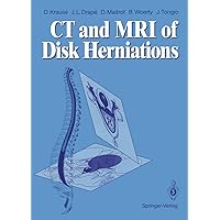 CT and MRI of Disk Herniations CT and MRI of Disk Herniations Kindle Hardcover Paperback